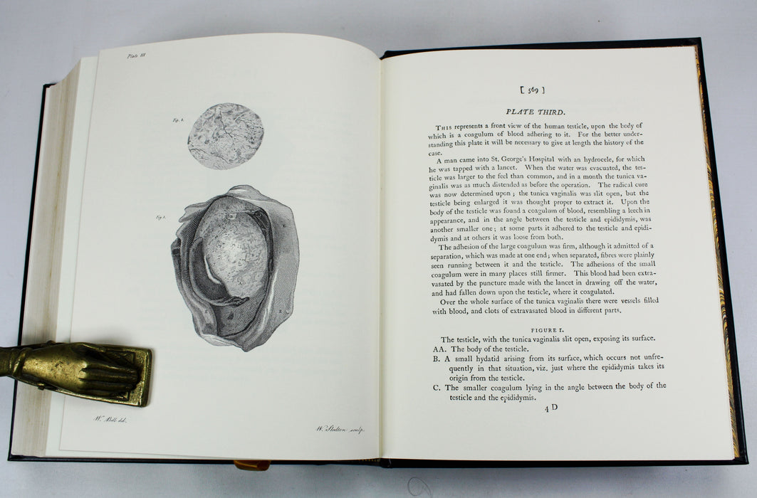 A Treatise on The Blood, Inflammation, and Gun-Shot Wounds, John Hunter, The Classics of Medicine Library, 1982
