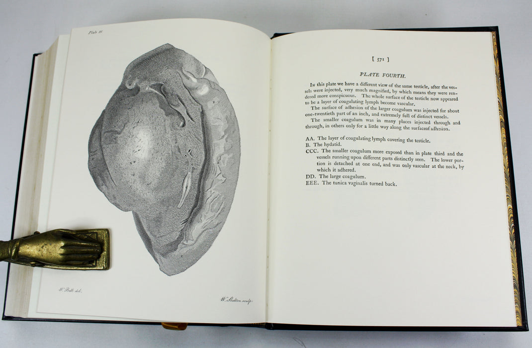 A Treatise on The Blood, Inflammation, and Gun-Shot Wounds, John Hunter, The Classics of Medicine Library, 1982