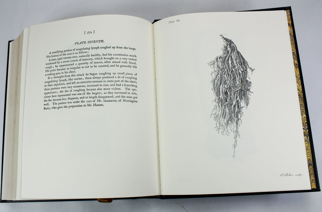A Treatise on The Blood, Inflammation, and Gun-Shot Wounds, John Hunter, The Classics of Medicine Library, 1982