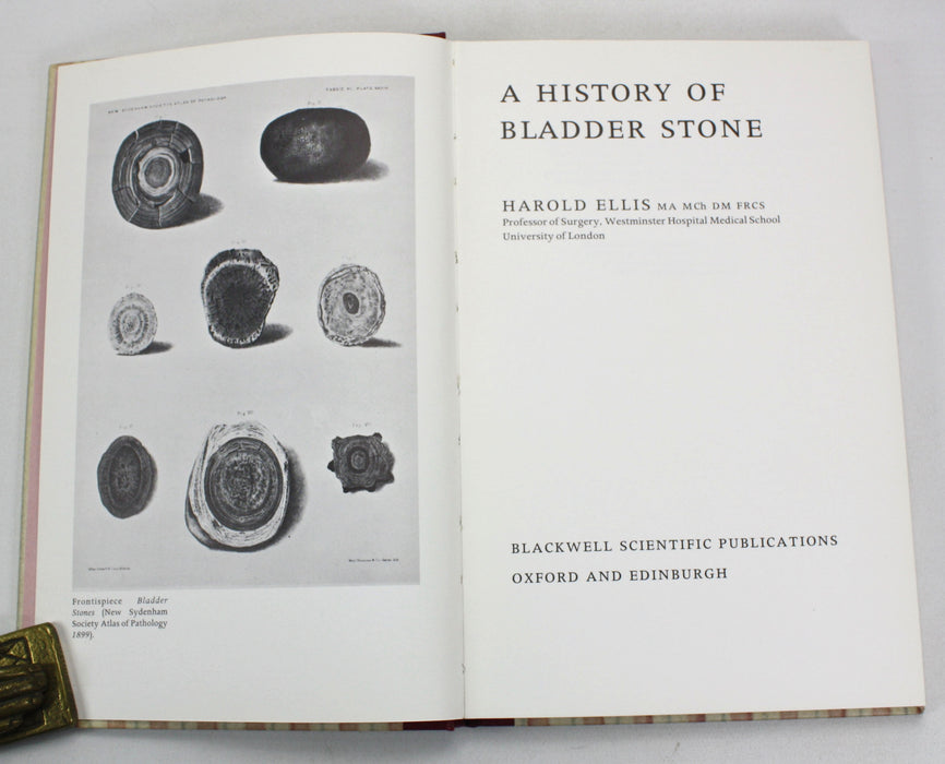 Medicine; A History of Bladder Stone, Harold Ellis, Blackwell Scientific Publications, 1969