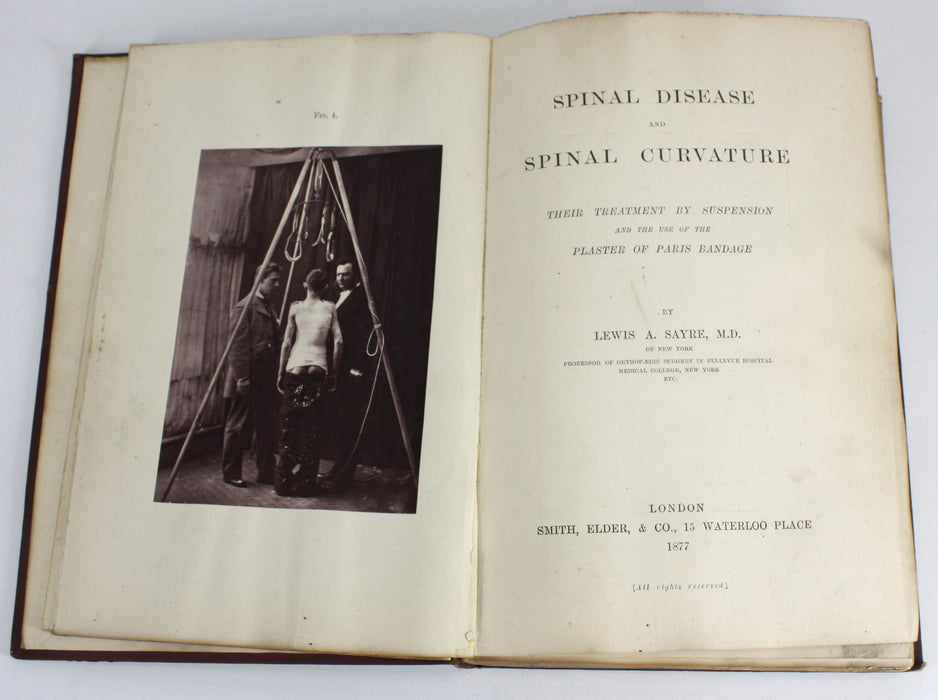 Spinal Disease and Spinal Curvature, by Lewis A Sayre, 1877